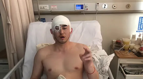 三次开颅!北体大一级运动员吴忠华:命运三连击,我笑着还手 三次开颅!北体大一级运动员吴忠华:命运三连击,我笑着还手