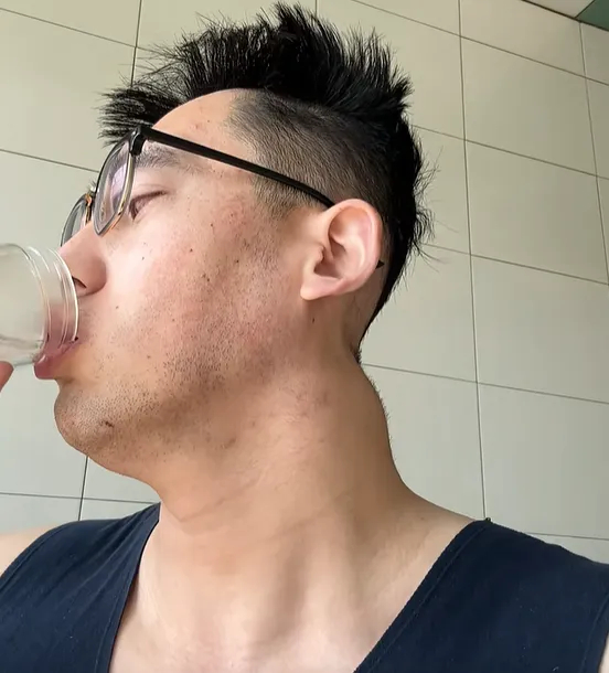 三次开颅!北体大一级运动员吴忠华:命运三连击,我笑着还手 三次开颅!北体大一级运动员吴忠华:命运三连击,我笑着还手
